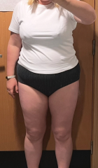 Anyone want to share their before and after pics?