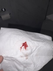 Miscarriage or chemical? Please can someone advise?