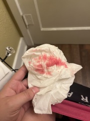 Could I be pregnant?