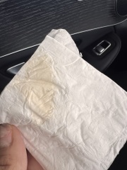 Peach/dark yellow discharge - is this normal
