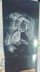BOY or GIRL