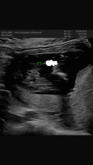 Boy or girl?? Any sonographers?