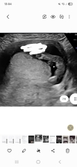 Boy or girl ? Any guesses?