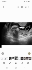 Boy or girl ? Any guesses?