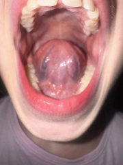 Daughters tongue