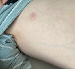 What are these spots?