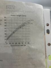 Femur length