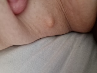 Weird Lump on Inner Thigh - ideas?