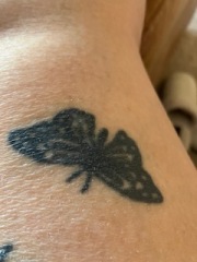Help! Can anything be done to salvage these tattoos?? PICS attached.