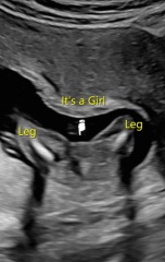 Does this look like boy or girl?💙💗😊