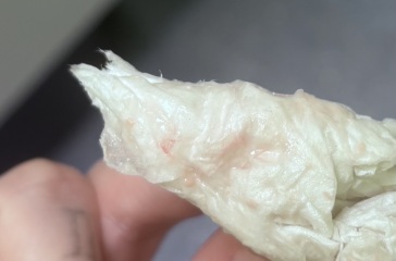 Implantation Bleeding? TMI PHOTO