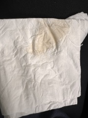 Peach/dark yellow discharge - is this normal