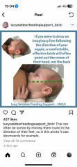 Breastfeeding with implants