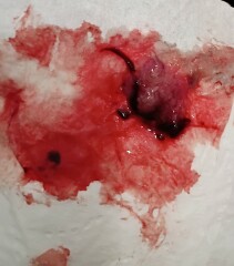 Warning: bloody pictures