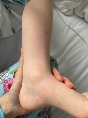 What are these spots?