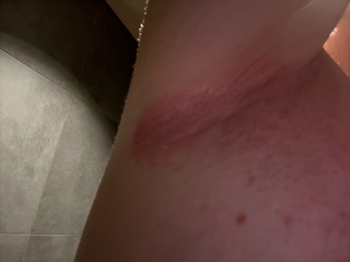 Red sore skin in both armpits - help!