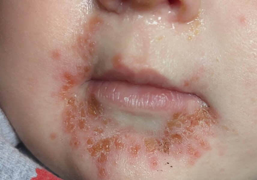 Is this HFM or something else?