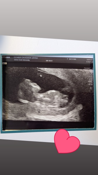 Boy or girl?