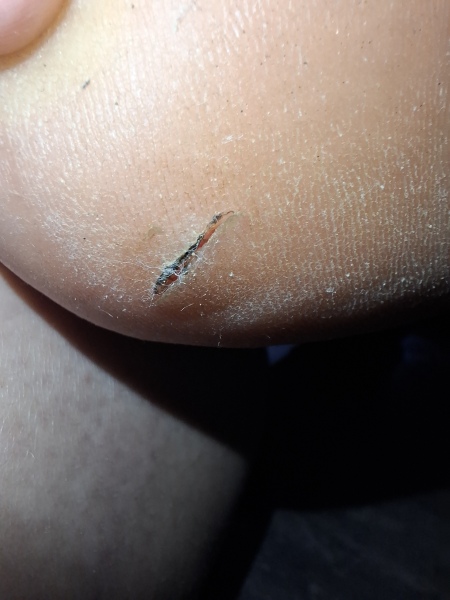 Will this just heal by itself?