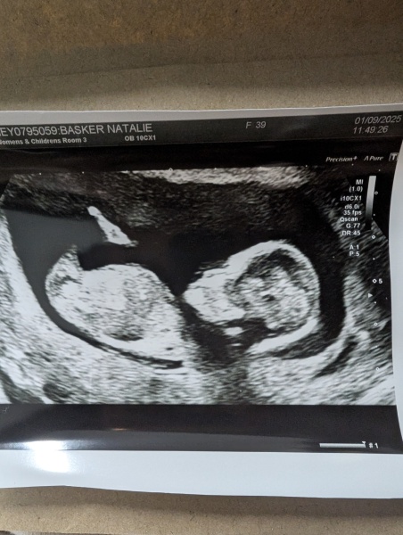 Due March 2026 🤍 pt 2