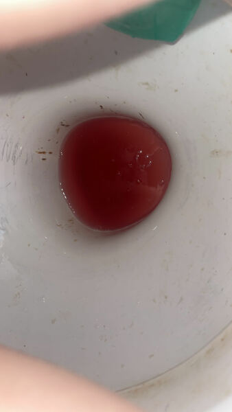 Is this implantation bleeding? It’s very watery