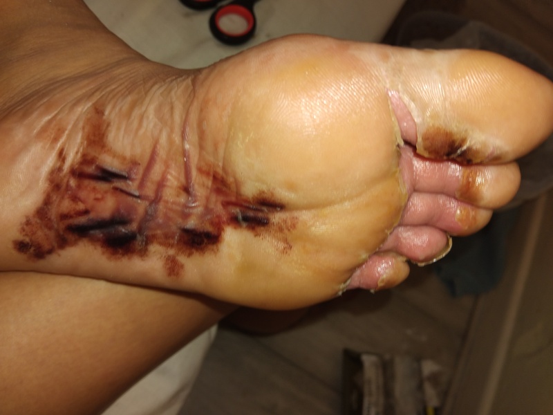 Shamelessly posting for traffic. Medical question and im definitely AIBU for posting disgusting pictures looking for answers