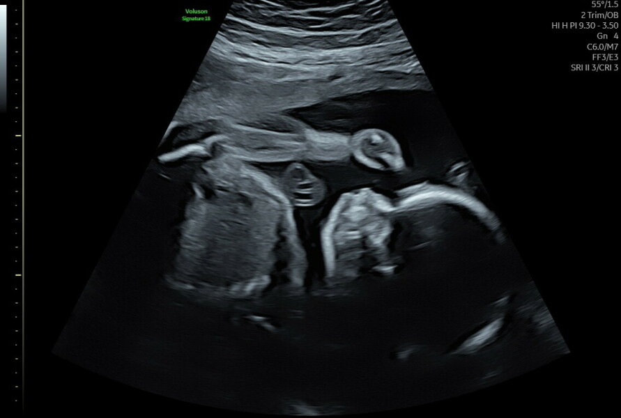 Due January 2026 - thread 2