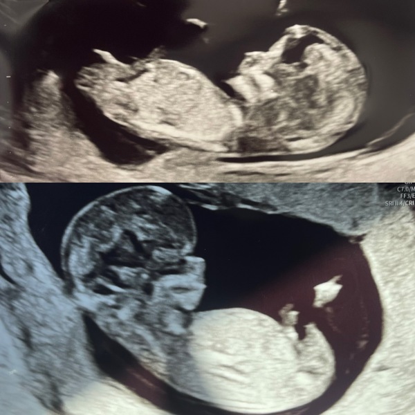 Nub Theory / Gender Guesses?