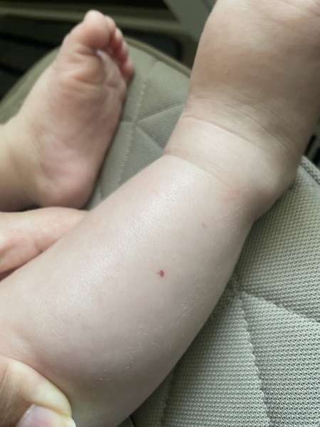 Any idea what this red mark is?