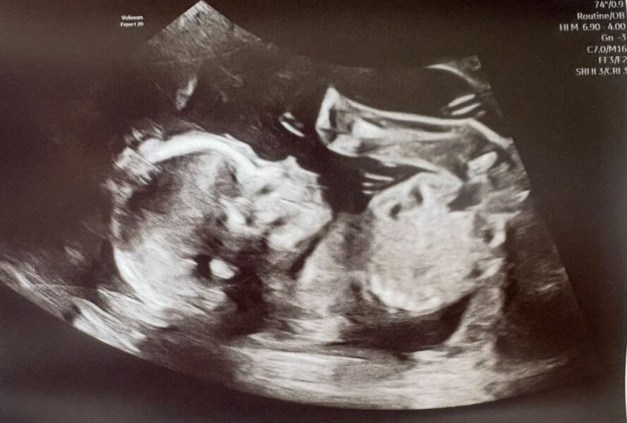 Due January 2026 - thread 2