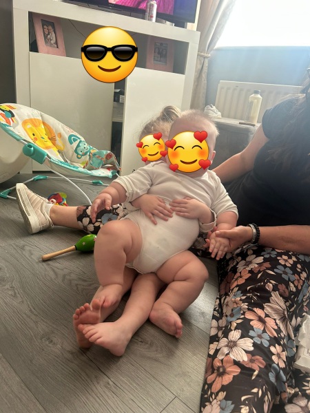 Can babies be obese?