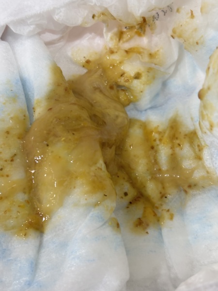 Please help, toddler poos getting progressively worse