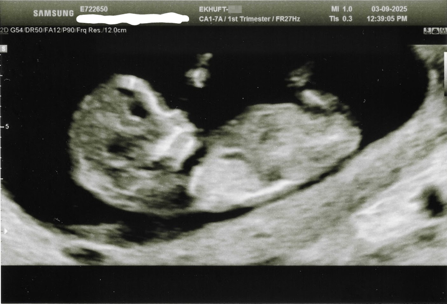 Pregnant with first baby