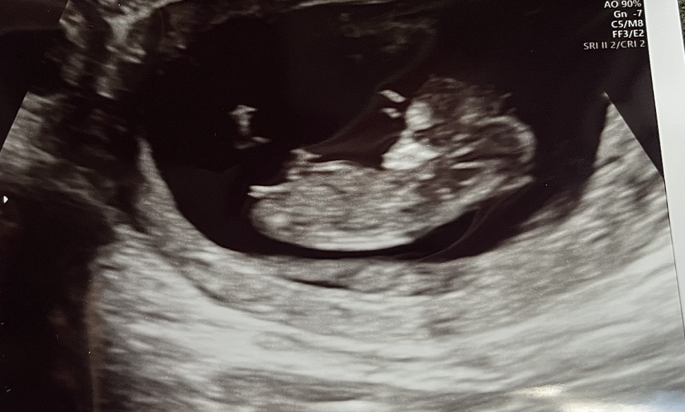 Boy or girl