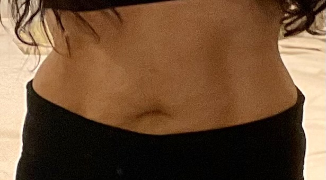 Any chance my 'apron' will disappear?!