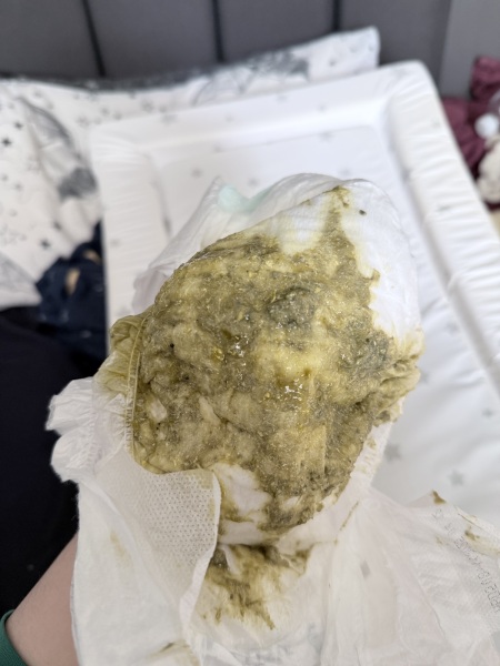 Puramino poo- is this normal?