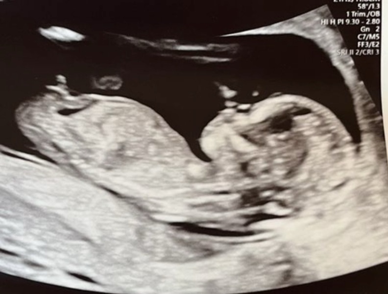 12 week gender guess!