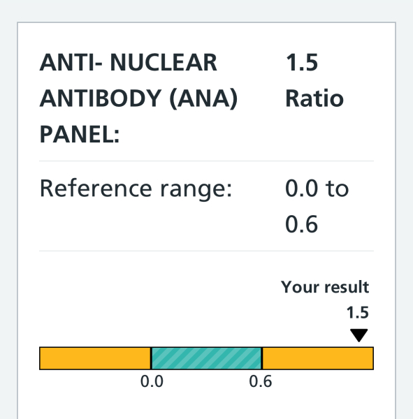 GP asked me to make appt to discuss blood results high ANA)