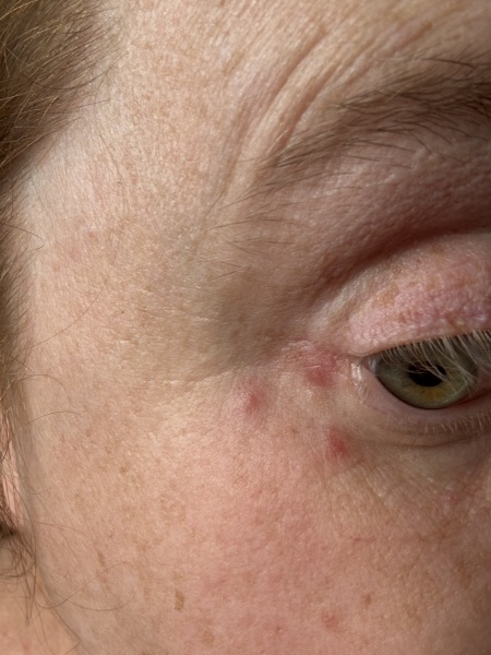 Ive been in  a and e with a family member and something odd has happened to my face what is it!!