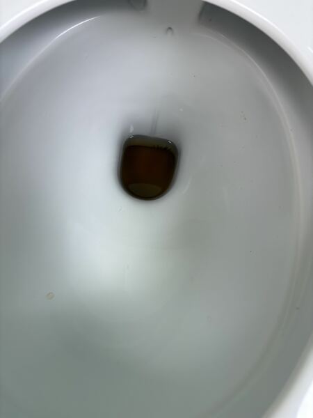 Impact of death on daughter constipated sick and accidents