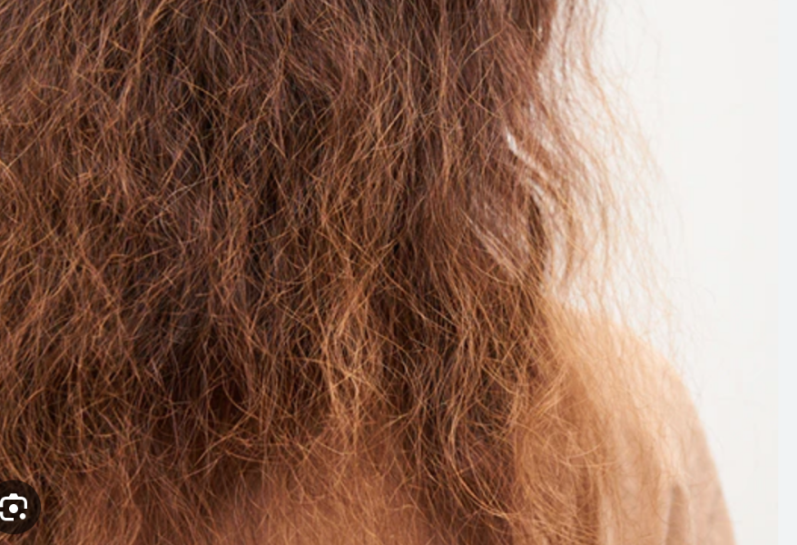 So I took all the hair advice and here I am with healthy shit hair.