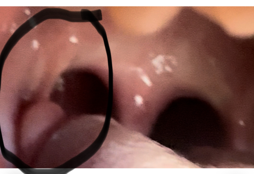 Would you be happy to wait this out TW - kids health / in mouth picture