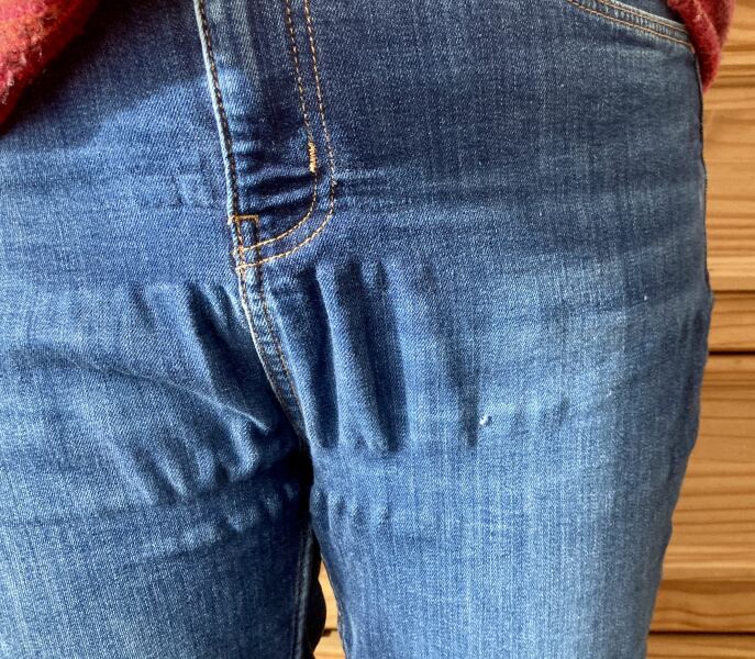 Why does this happen to all my jeans?