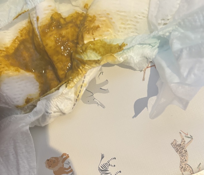 Is this baby Diarrhoea? Poo picture :/