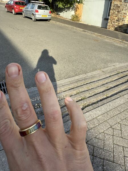 This is a semi normal burn, right?