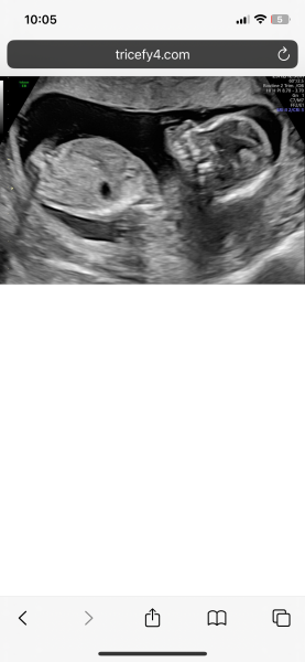 Does my baby’s face on ultrasound look normal?