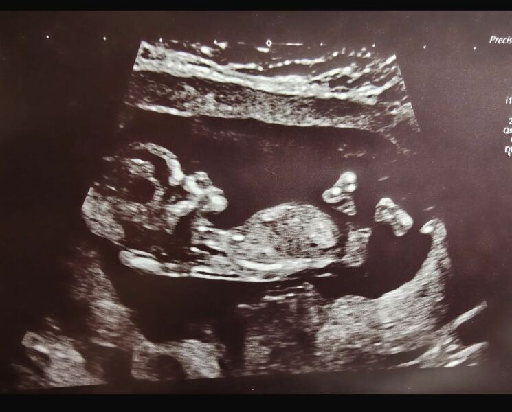 Gender ?
