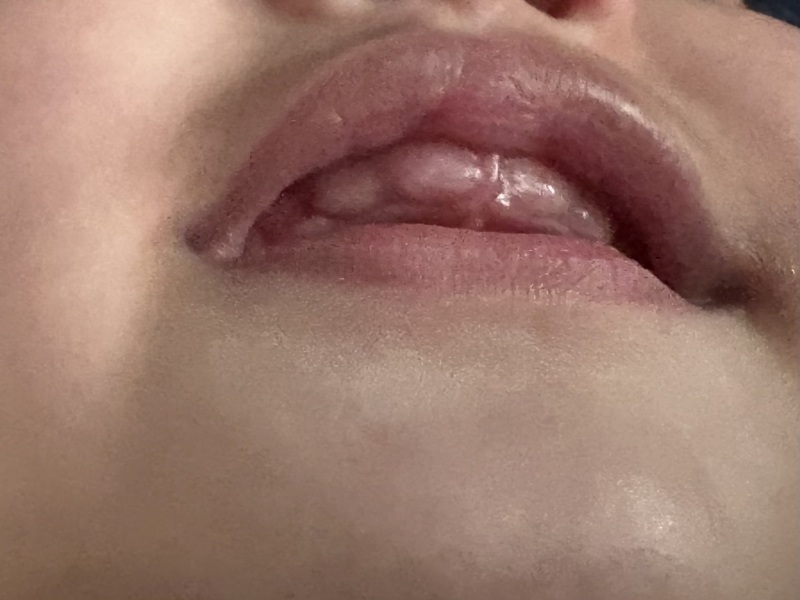 Do these look like teeth coming?