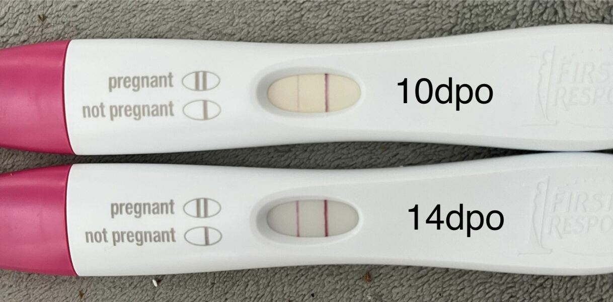 Line progression