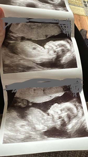 Faint line at 12dpo?